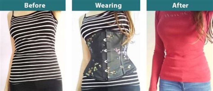 Can corsets change your rib shape
