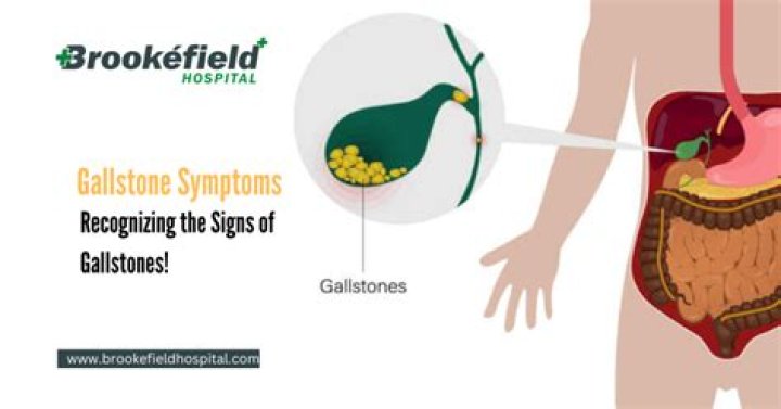 Do gallstones cause enlarged spleen