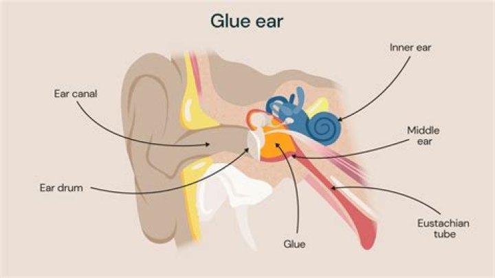 How do you glue Aussie ears