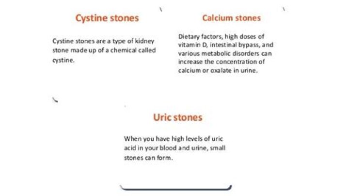 How do you prevent cystine stones