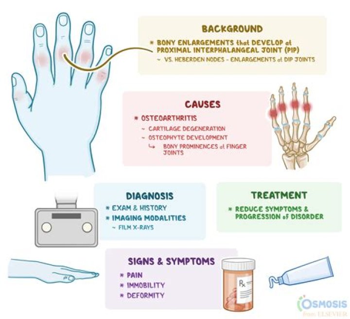 How much is Albert Bouchard worth