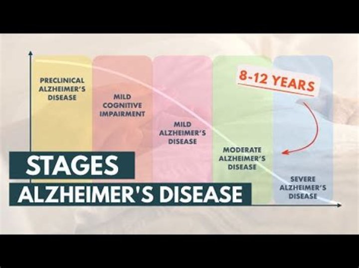 How much is Alois Alzheimer worth