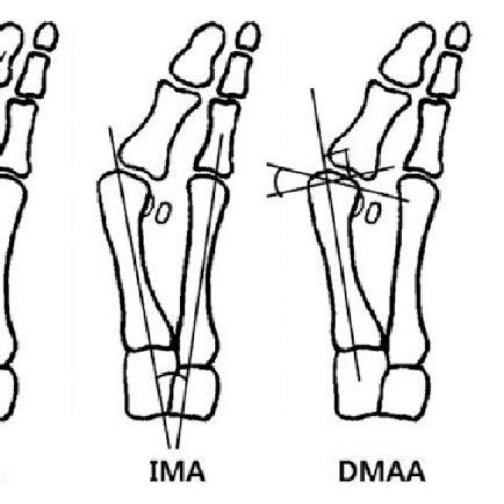 What does DMAA do to the body