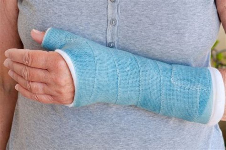 What is a short arm cast used for